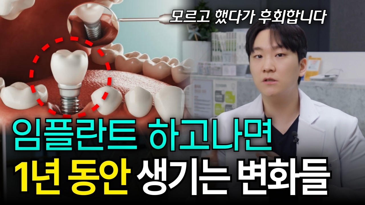 임플란트 수술 후 1년 동안 벌어지는 일, 3단계를 알아야 돈 안 날립니다 [대구치과, 바른손치과]
