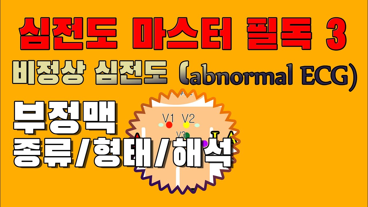 부정맥  / 부정맥 마스터 / 부정맥 종류 / 부정맥 파형 / 전기축 / 간호 학과