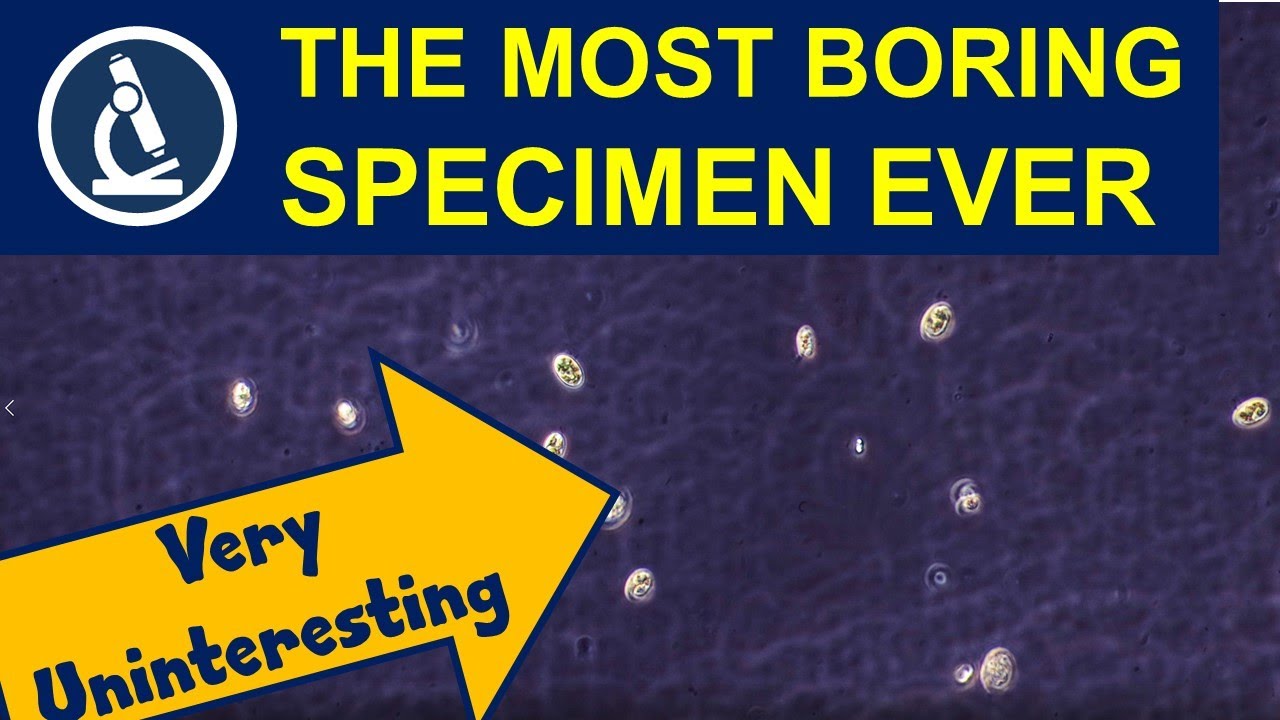 I found only few interesting specimens. Why is that? 🔬 Troubleshooting microscopy