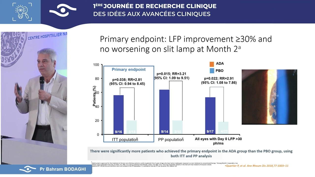Immunothérapie des uvéites
