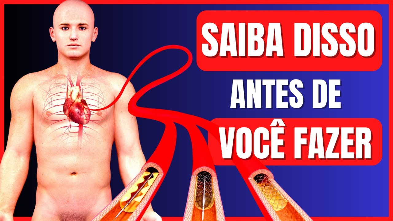CATETERISMO CARDÍACO e ANGIOPLASTIA | INFORMAÇÕES IMPORTANTES