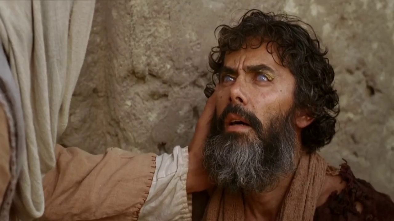 ISO Masih tug`ma ko`rni sog`aytirishi .