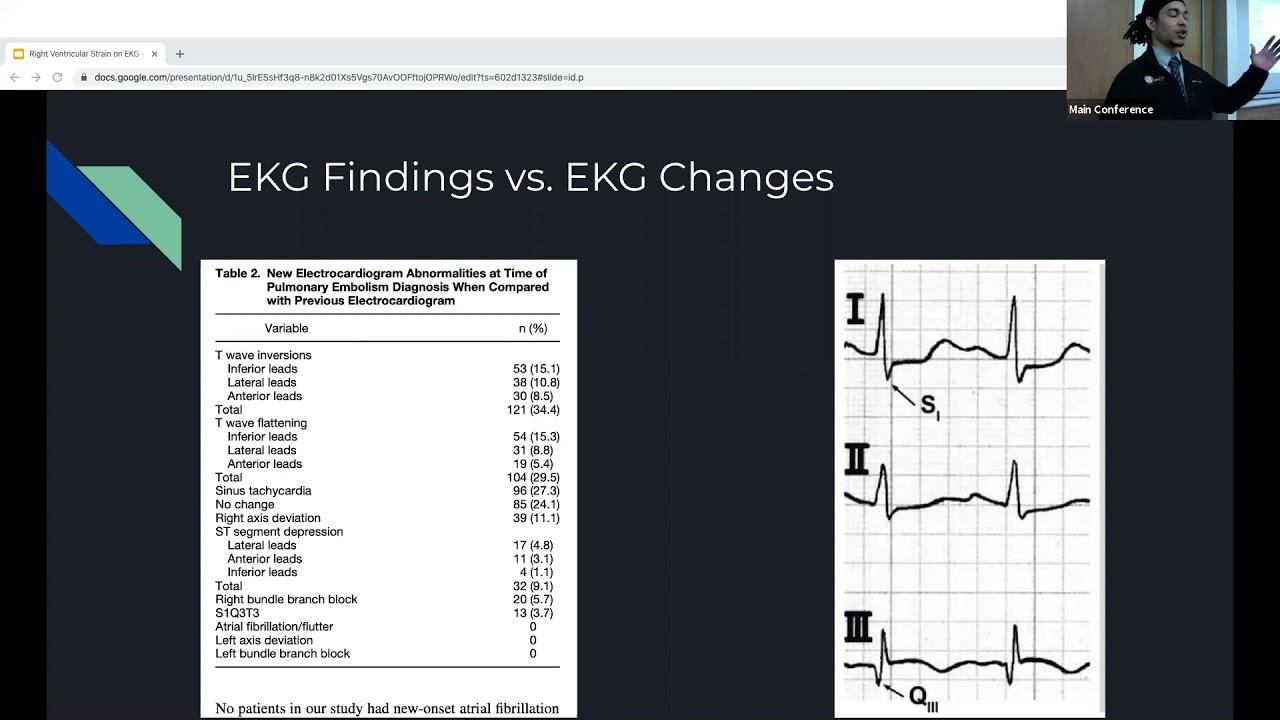 Dr Dow   EKG Findings of Right Heart Strain