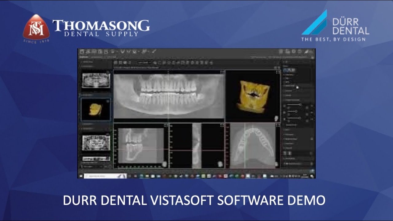 Demo Software Vistasoft Durr Dental