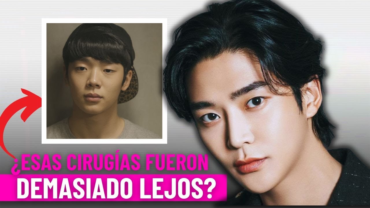 Las Cirugías Plásticas Más Extremas en la Historia de los Doramas