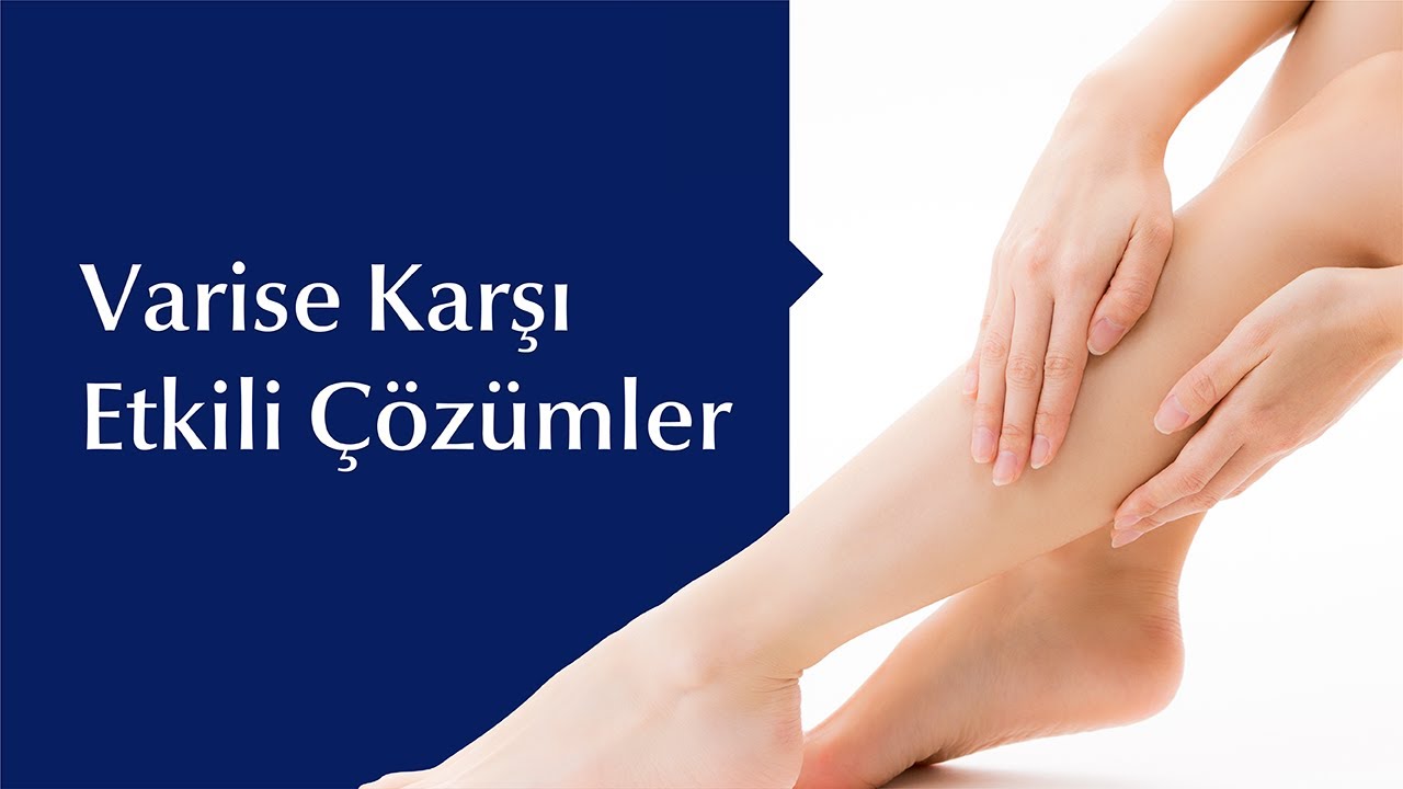 Varis Nedenleri, Belirtileri ve Tedavi Yöntemleri Nelerdir?