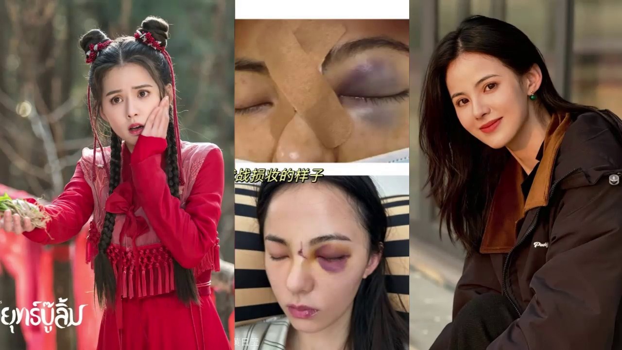 หวงรื่ออิ๋ง. ลดเกรดเล่นซีรี่ส์แนวตั้ง หลังประสบอุบัติเหตุ หวิดเสียโฉม