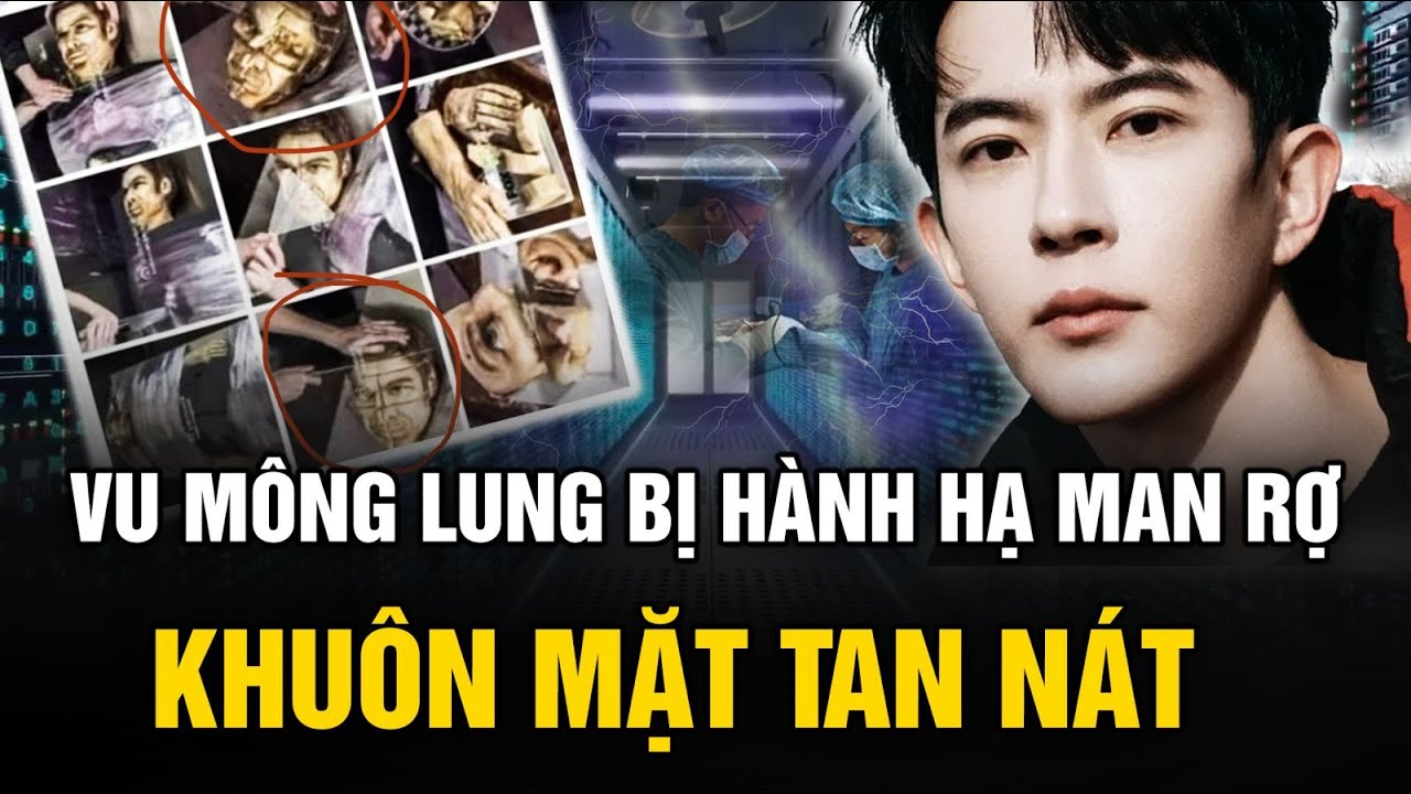 Lộ tin Vu Mông Lung bị hành hạ man rợ như bánh “phân thây”, khuôn mặt biến dạng hoàn toàn