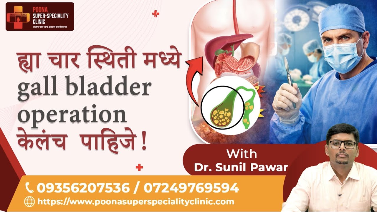 या 4 परिस्थितींमध्ये Gall Bladderचे Operation केलच पाहिजे!|Dr. Sunil Pawar| #gallbladder #gallstones