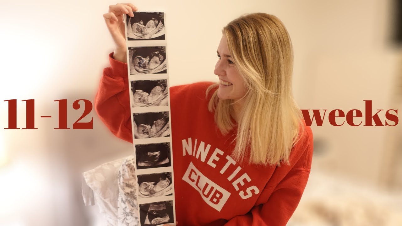 12 WEEKS PREGNANT WITH BABY #2: 12 Week NHS Dating Scan UK & First Trimester Vlog! 👶✨