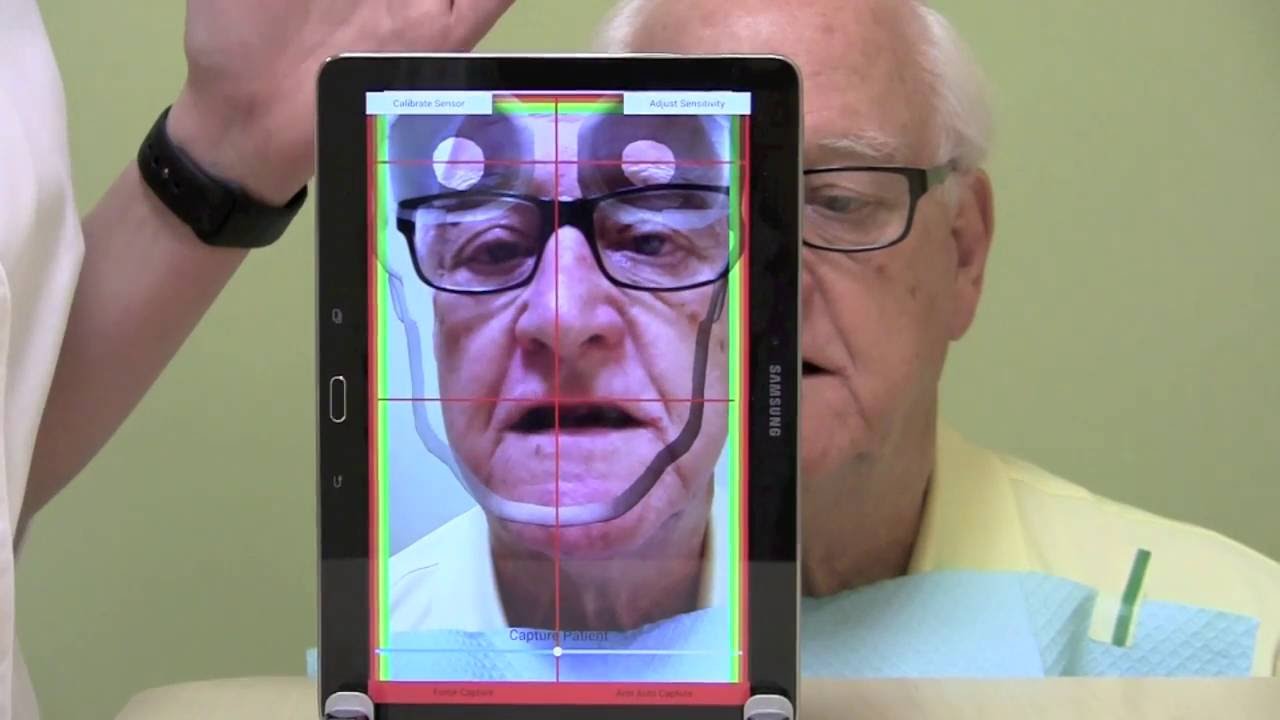 MaxAlign and the Edentulous Patient