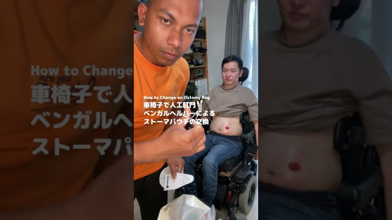 ベンガルヘルパーによる車椅子上でストーマパウチ交換　#shorts