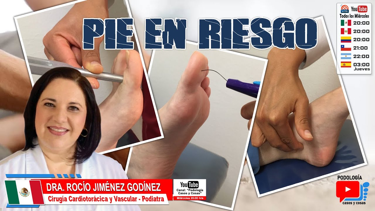 PIE EN RIESGO | Dra Rocío Jiménez Godínez | Podología Casos y Cosas
