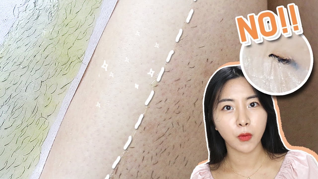 효과최고🔥🔥 다리털 인그로운헤어 안생기게 왁싱 하는 법