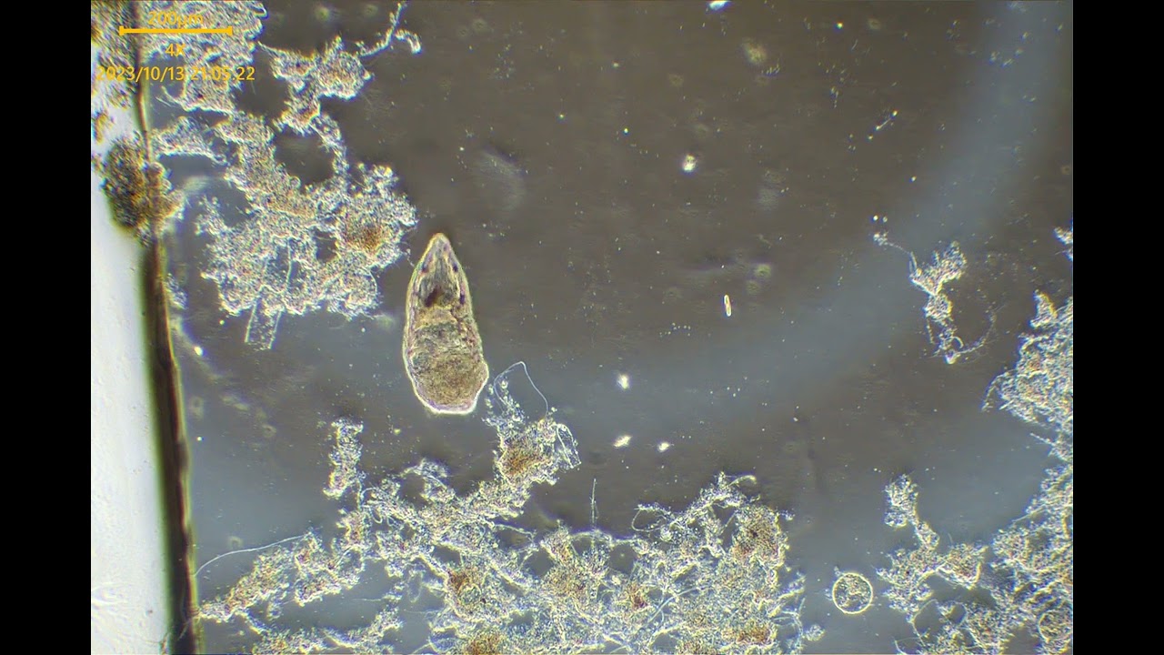 4K活性汚泥の微生物　カテヌラ(Catenula)の突然死の瞬間