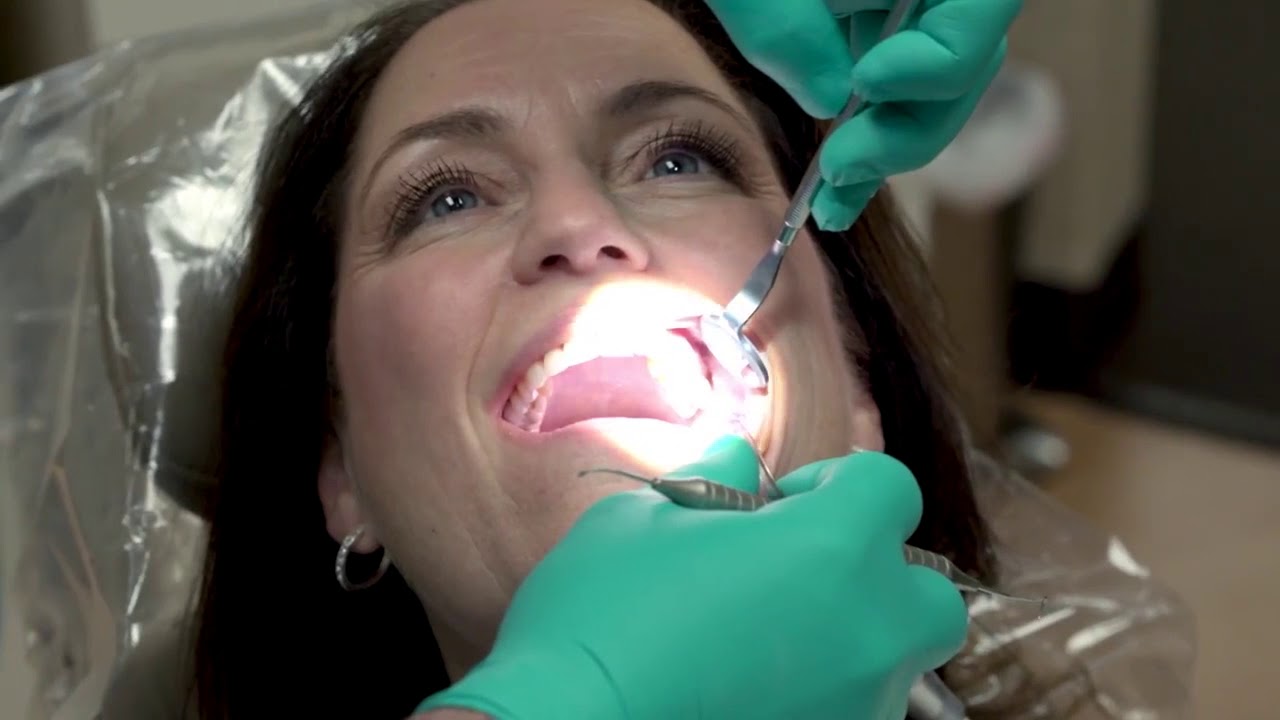 No-Prep Veneers: Conservative Treatment for Impressive Results
