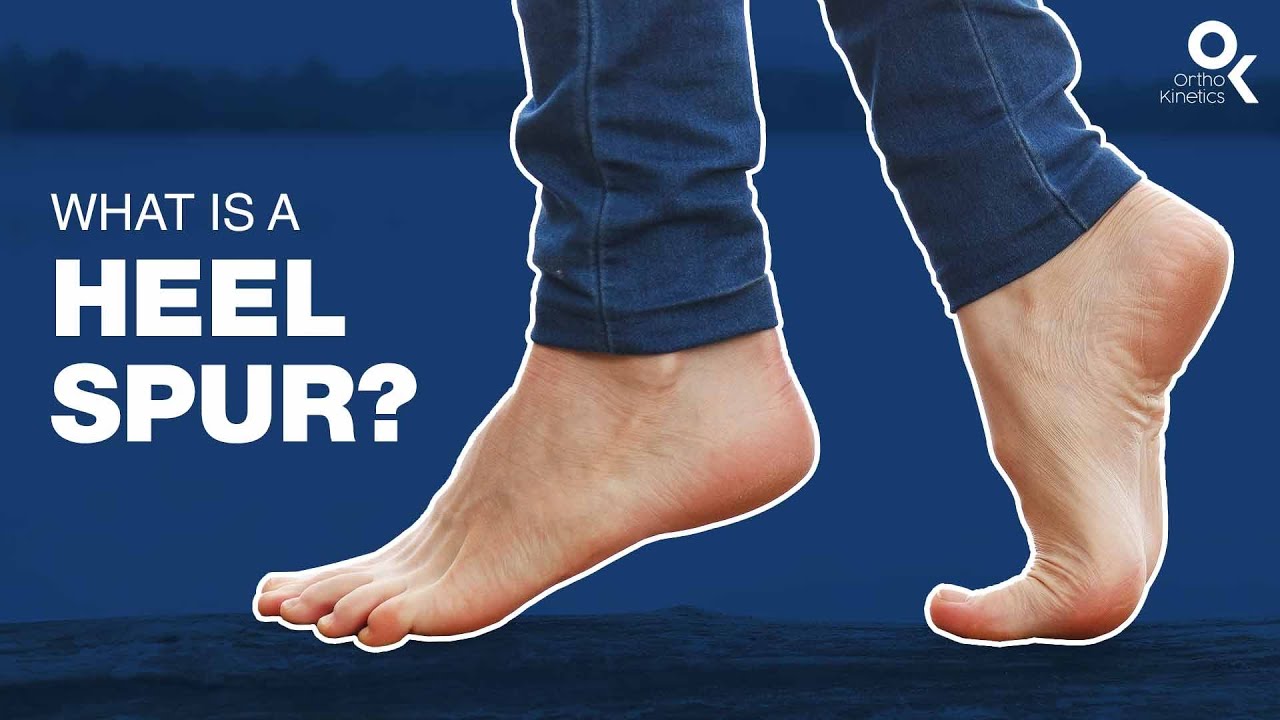 What Is A Heel Spur? | Dr Sean Leo (OrthoKinetics)