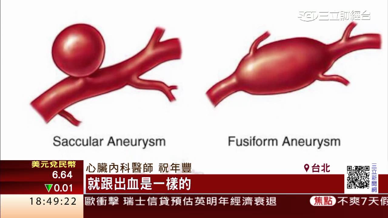 爆炸般頭痛！小心腦血管瘤破裂｜三立財經台CH88