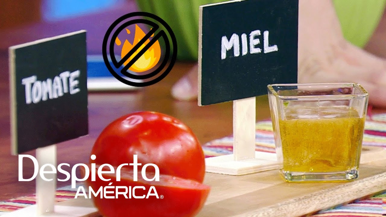 Remedios naturales para quemaduras en la cocina