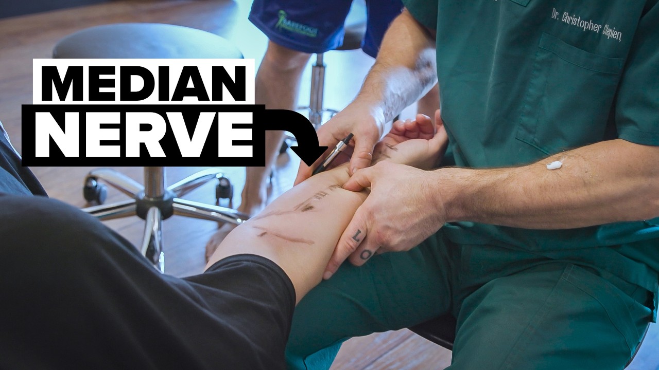 Pronator Teres vs Median Nerve: How to Separate What’s Actually Stuck