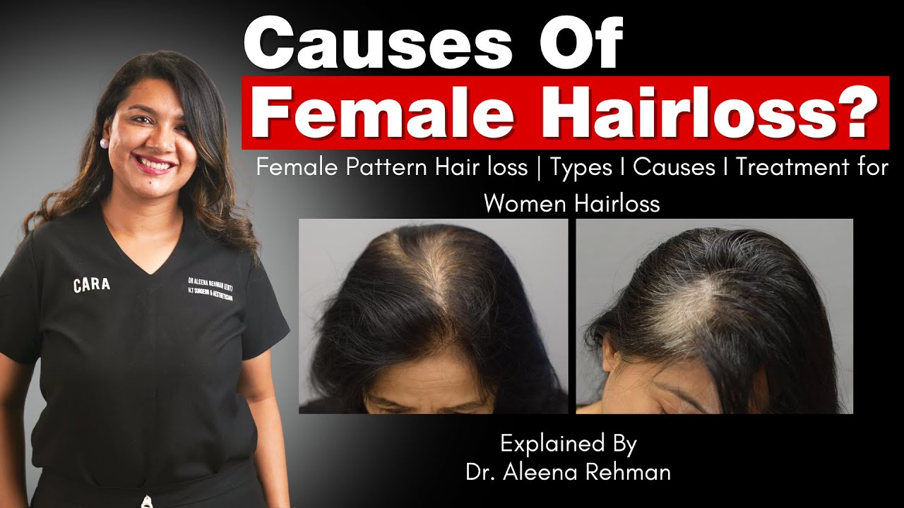 The Truth About Female Hair Loss: Causes, Types, and Treatments.