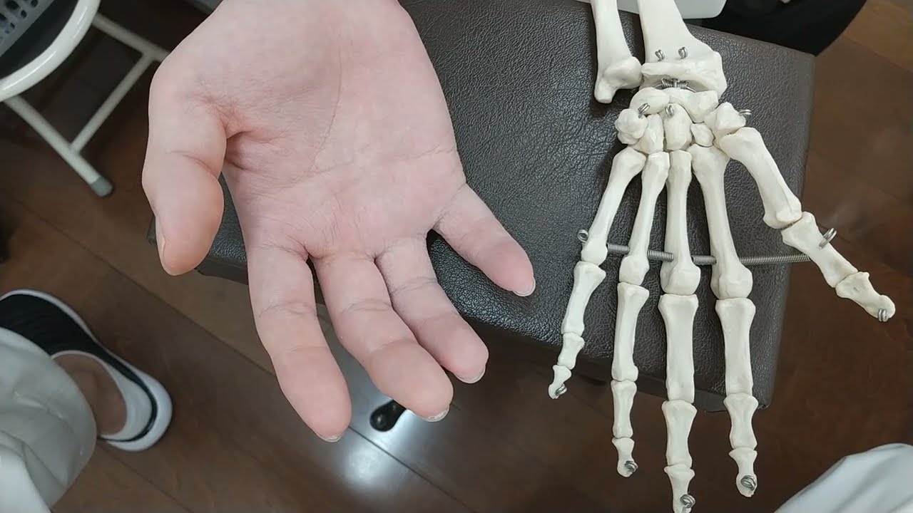 小指の脱臼骨折後の拘縮 　春日部　ときだ接骨院鍼灸院 little finger fracture contracture