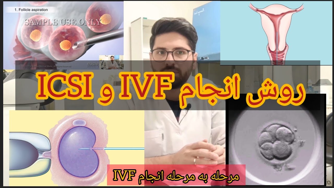 روش انجام IVF و ICSI | لقاح خارج رحمی چطوری انجام میشود|لقاح مصنوعی اسپرم| تزریق اسپرم به داخل تخمک