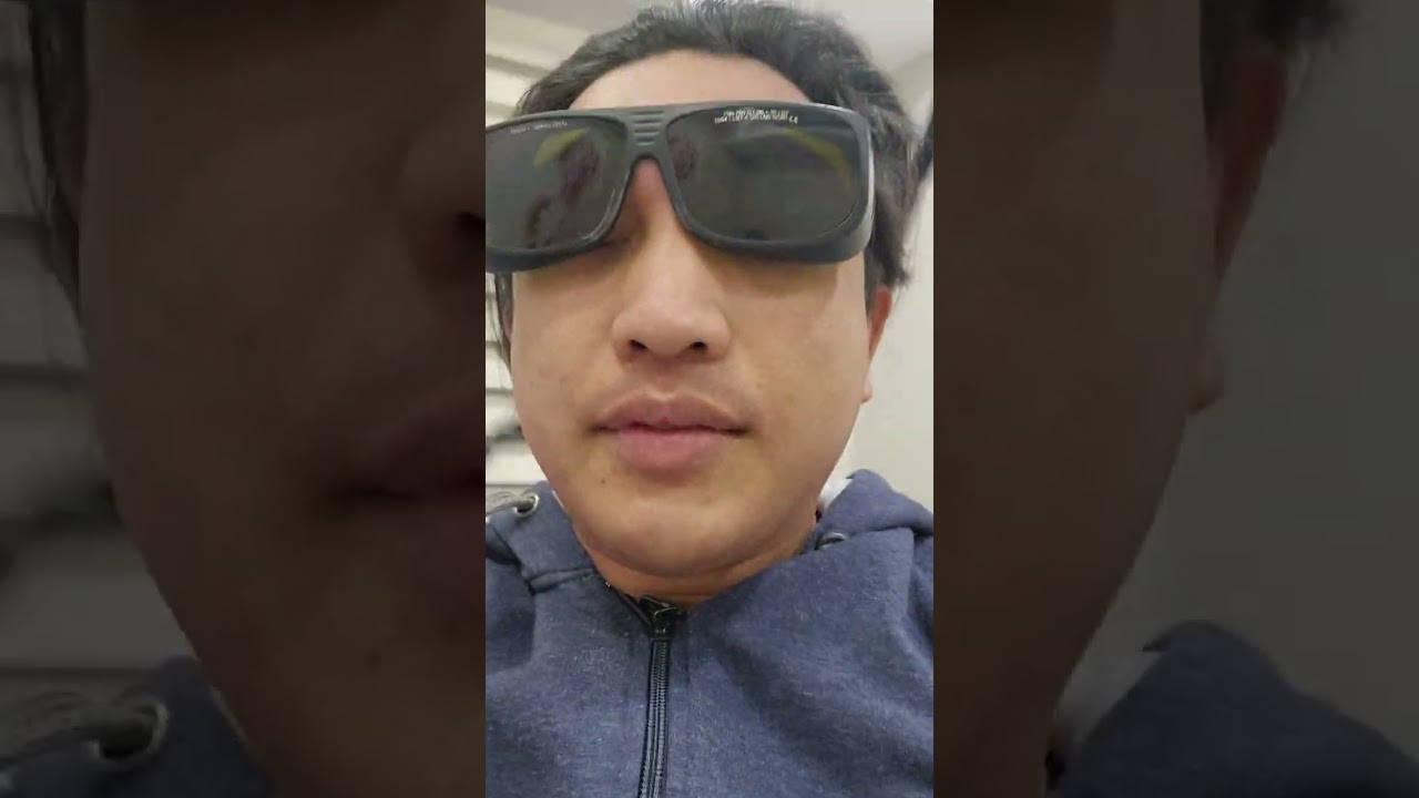 Face laser