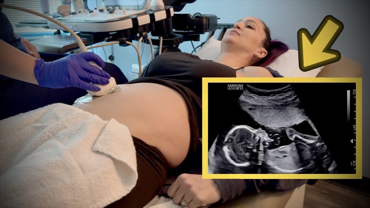 We Got Some Bad News - (20 Week Ultrasound Anatomy Scan)