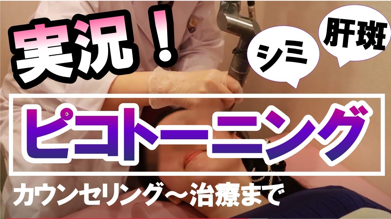 【シミ・肝斑治療】ピコトーニングを体験！カウンセリング～治療～アフターカウンセリングまで。痛みや施術後の肌、ダウンタイム、施術後のスキンケアの注意点は？｜美容医療