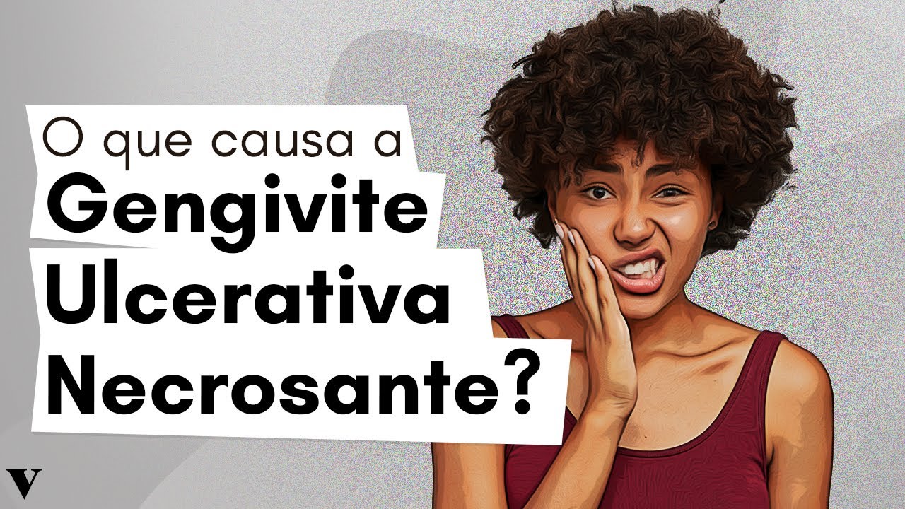 Gengivite Ulcerativa Necrosante É o Que? Confira!