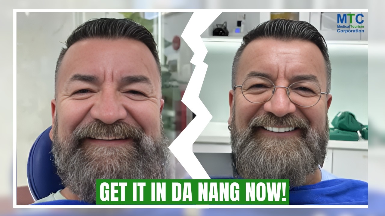 Dental Work in Da Nang, Vietnam: Treatments, Costs, and Timelines!