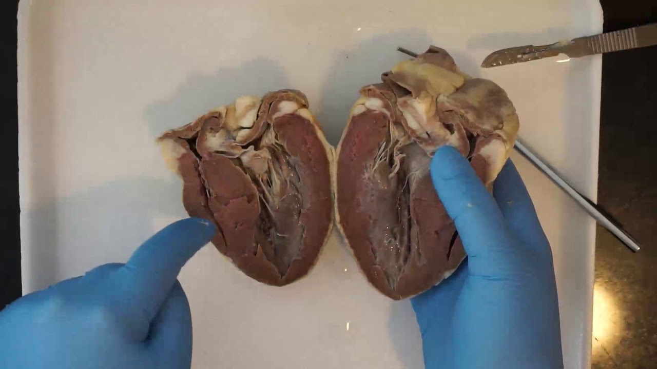 Heart Dissection