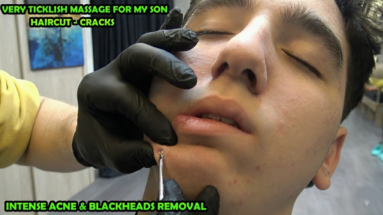 I REMOVAL MY SON'S TEENAGE ACNE & BLACKHEADS + HAIRCUT + CRACKS + ASMR Head, Face, Ear, Neck Massage