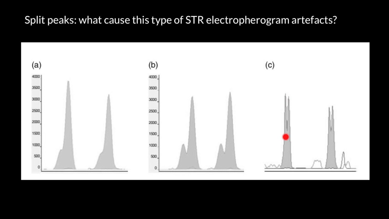 Split peaks - what cause this type of electropherogram artefacts?