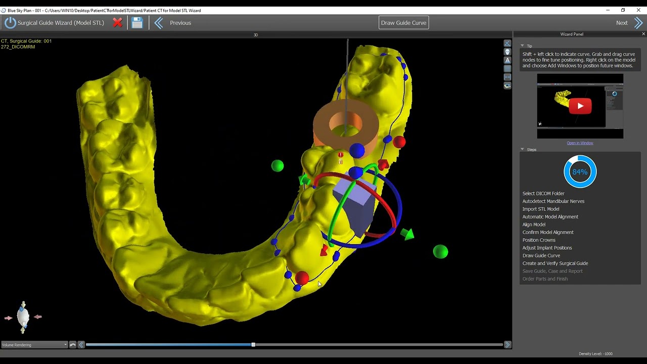 Adding Windows to Your Surgical Guide