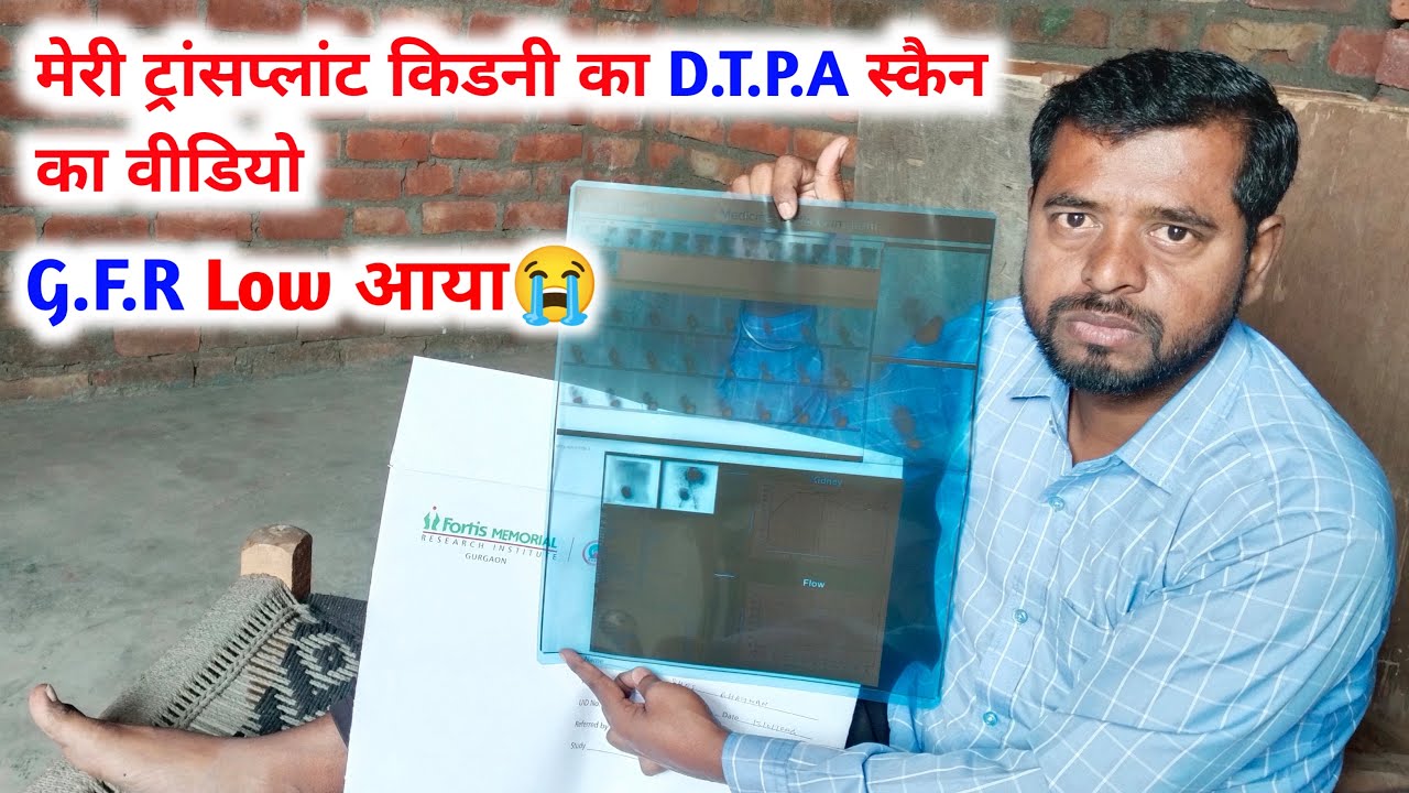 मेरी ट्रांसप्लांट वाली किडनी का D.T.P.A scan का विडियो 🎥 SB kidney health 