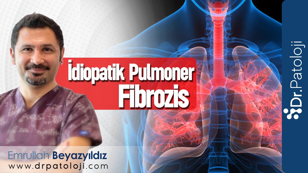 İdiopatik Pulmoner Fibrozis