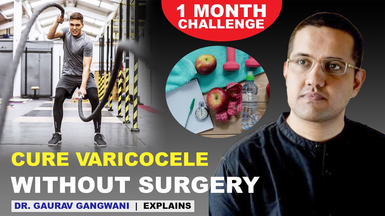Varicocele natural treatment | Varicocele treatment without any surgery | Dr. Gaurav Gangwani