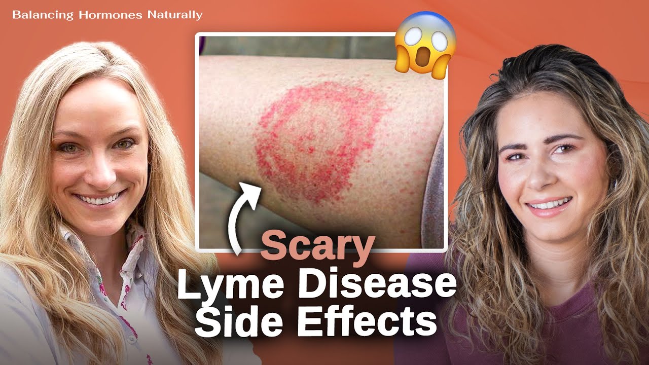 Everything to Know About Lyme Disease: Prevention, Diagnosis, & Treatment | Dr. Casey Kelley