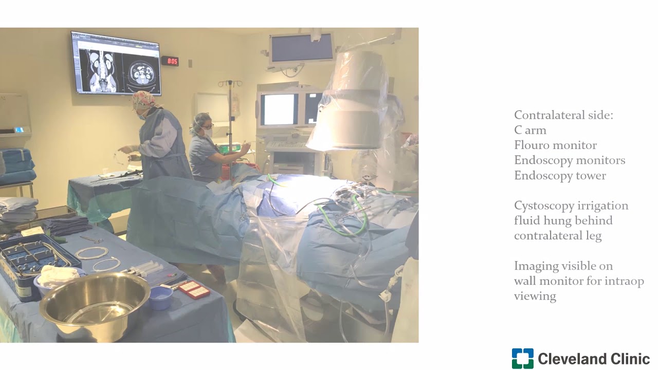 Urology Times Prone, split-leg, fluoroscopy-guided percutaneous access for nephrolithotomy