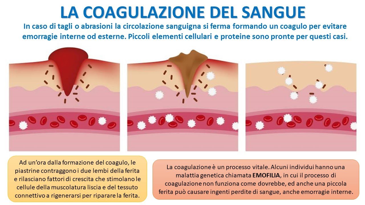 LA COAGULAZIONE DEL SAUNGUE