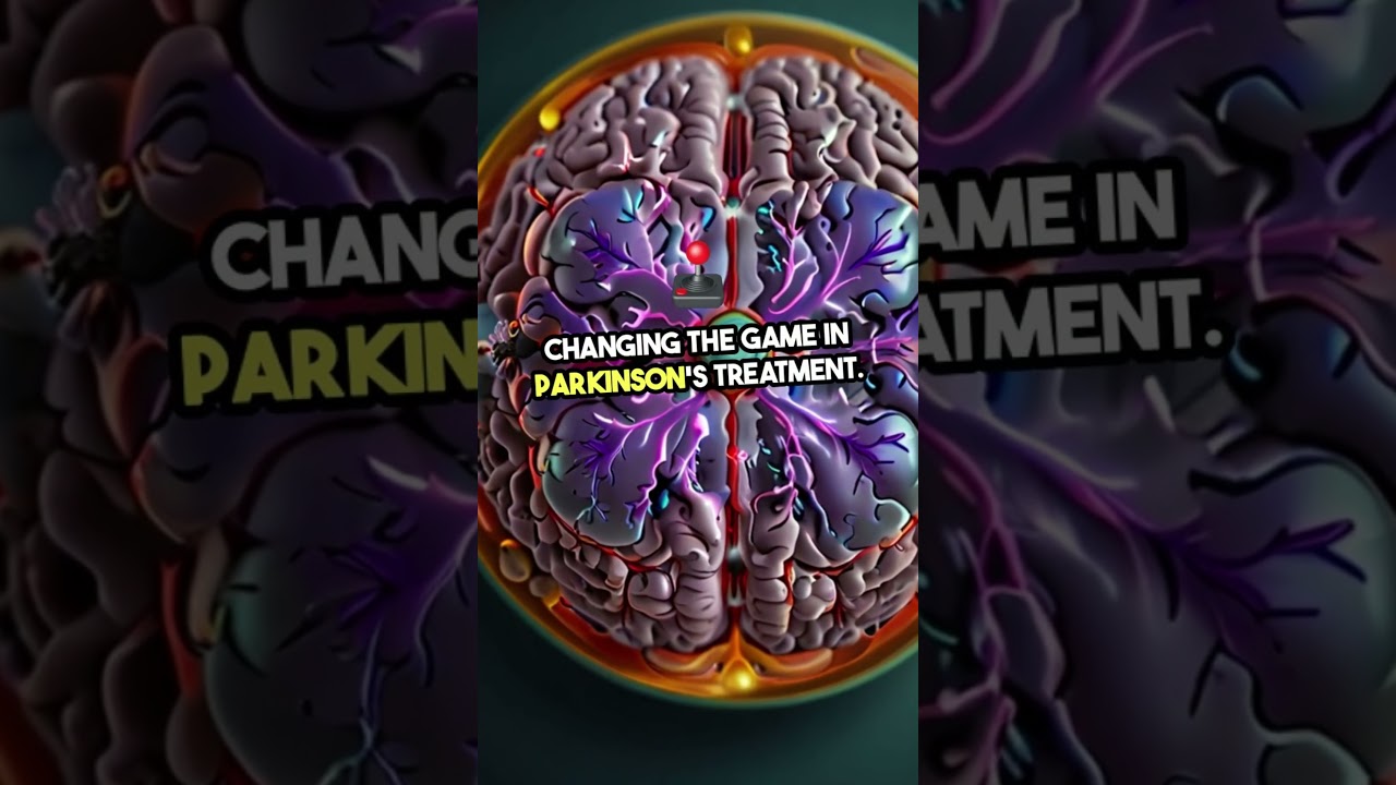 The AI Revolution in Parkinson's Treatment #Parkinsons #BrainPacemaker #AI #Neuroscience