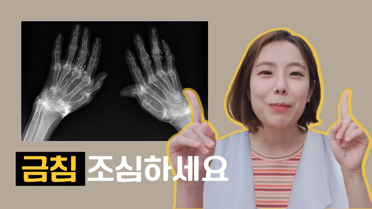 금침하신 분들! MRI 촬영시 조심하세요
