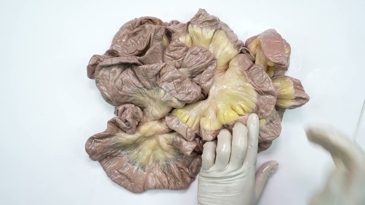 How to differentiate between jejunum and ileum?