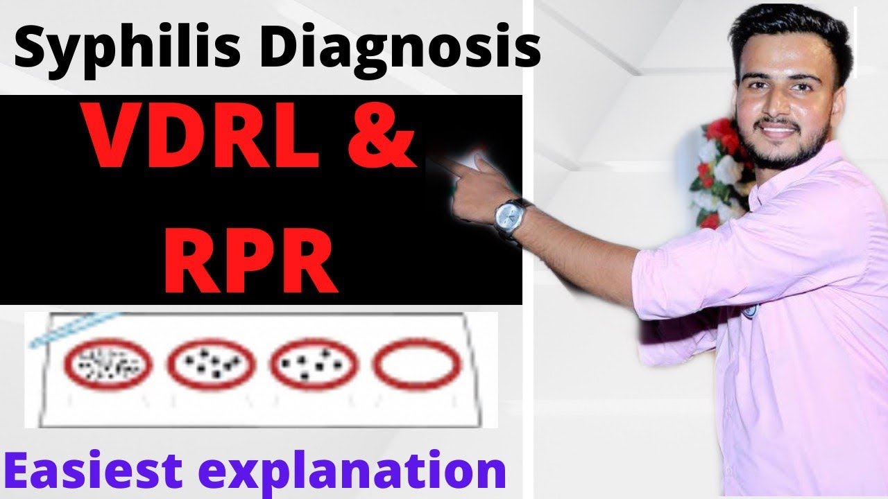 VDRL & RPR TEST / VDRL TEST IN HINDI / SYPHILIS DIAGNOSIS TESTS