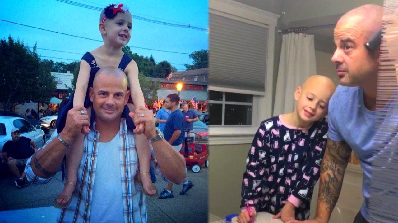 Dad Shaves Head to Cheer Up Daughter Who Lost Hair to Alopecia