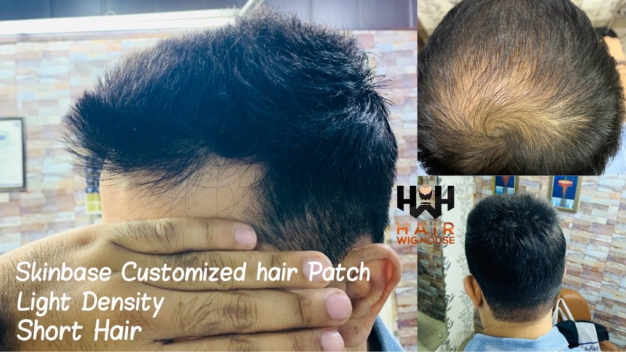 Skin Base | Light Density Hair patch | Non surgical Hair Transplant in Delhi & Chandigarh 9953384242
