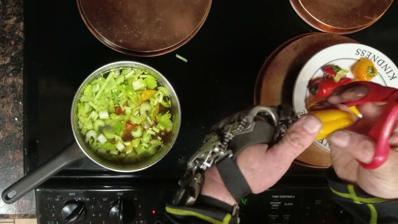 Использование протеза руки в реальных условиях.