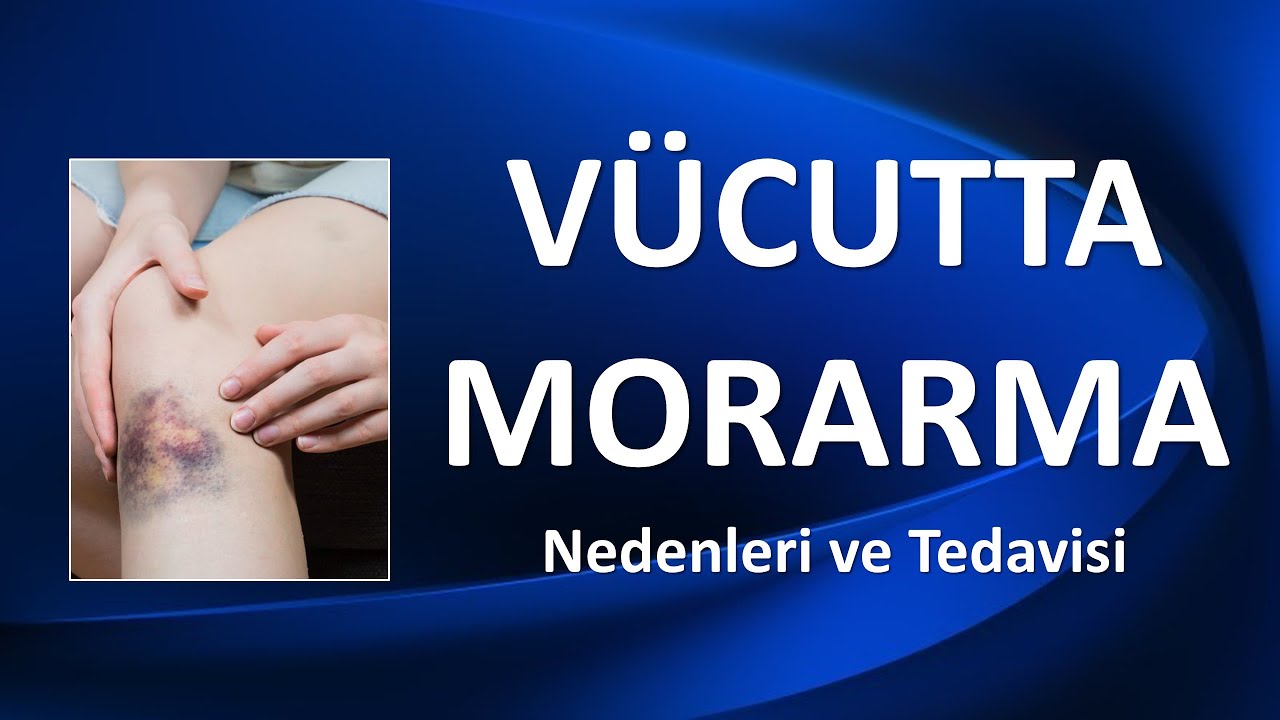 V&Uuml;CUTTA MORARMA NEDEN OLUR?